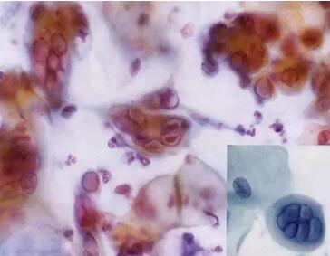 ���ϴ���ӣ��������ךW���M(j��n)�ھ�ϴ�O(sh��)���ꑌ�������Ҽ�